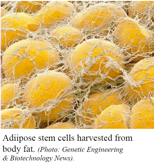 adipose stem cell therapies